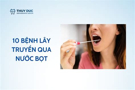 10 bệnh bệnh lây qua đường nước bọt CÓ THỂ BẠN CHƯA BIẾT Nha Khoa