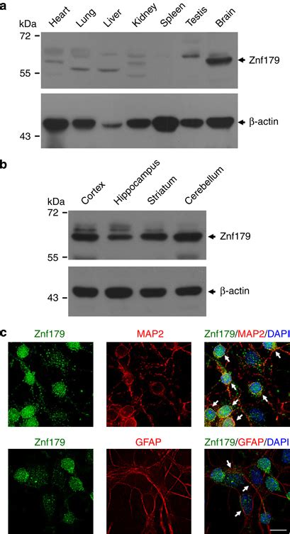 Expression Patterns Of The Znf Protein A And B Western Blot