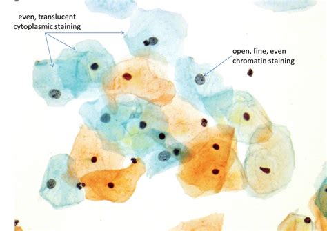 Pap Staining Cytolog Papanicolaou Staining