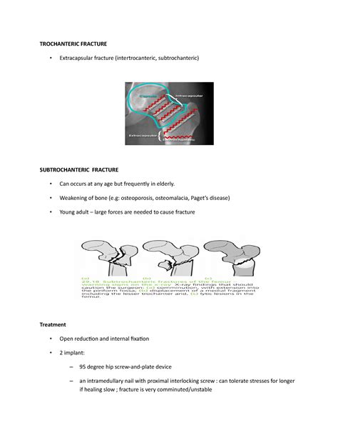 Trochanteric Fracture - Essential Surgery - TROCHANTERIC FRACTURE ...