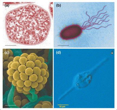 Spatial Scaling Of Microbial Biodiversity Trends In Ecology Evolution