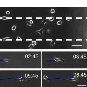 Hela Cell Migration In A Microfluidics Chamber Sticky Slide Chemotaxis