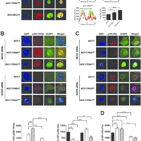 dusp  moderately expressed  malignant  breast cancers dusp