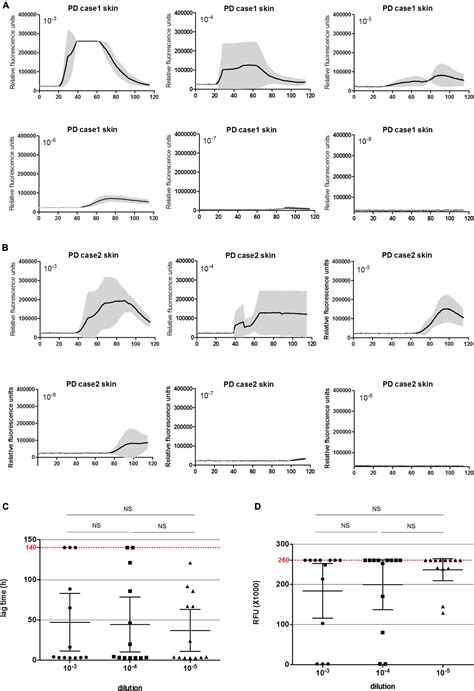 Frontiers Application Of Syn Real Time Quaking Induced Conversion