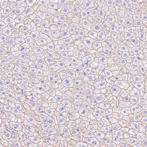 S Rmab® Keratin 18 Recombinant Rabbit Mab Sdt 012 7p05783starter Bio