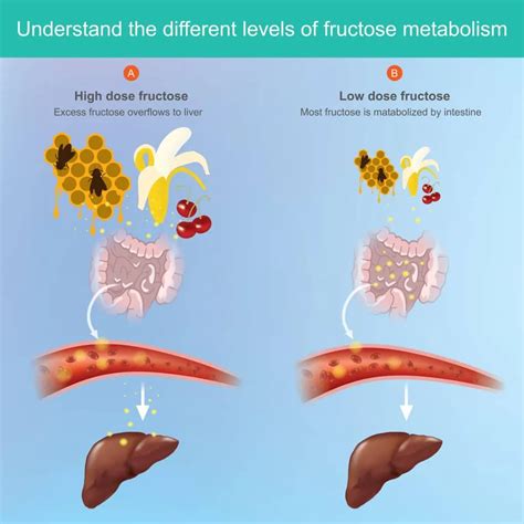 What Causes Fatty Liver Disease Pompa Program Masterclass