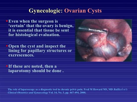 Diagnostic Laparoscopy For Pelvic Disorders