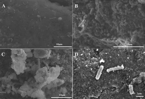 Scanning Electronic Microscopy images of biofilm matrix on the surface ...