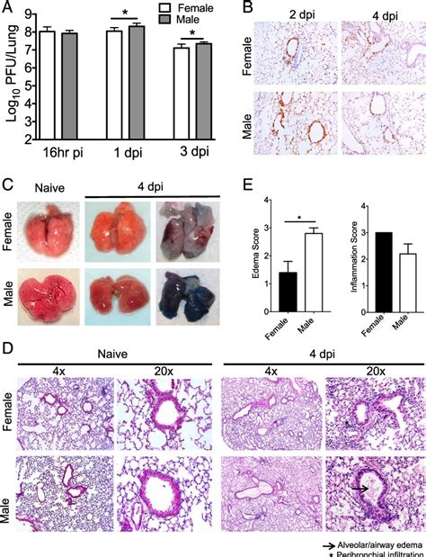 Figure From Sex Based Differences In Susceptibility To Severe Acute Respiratory Syndrome