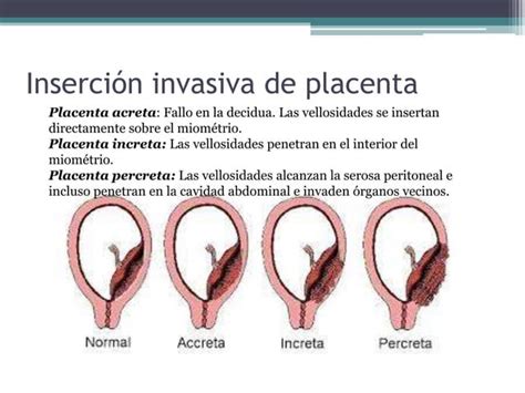 Hemorragia Posparto Y Retenci N Placentaria Ppt