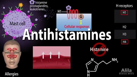 Can Antihistamines Cause Sinus Infections