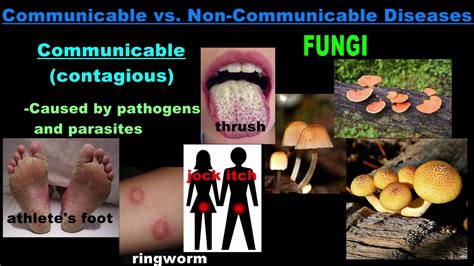 Non Communicable Diseases List - Non-Communicable Disease - don't let ...