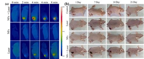 Thermal IR Images Of The 4T1 Bearing Nude Mice After Intratumoral