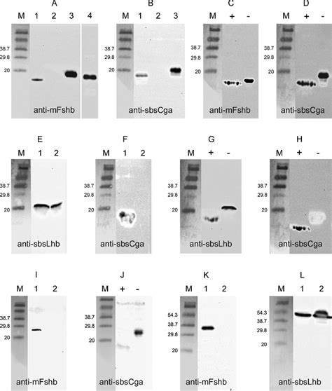 Western Blot Analysis Of Recombinant Gths Proteins In Culture Medium