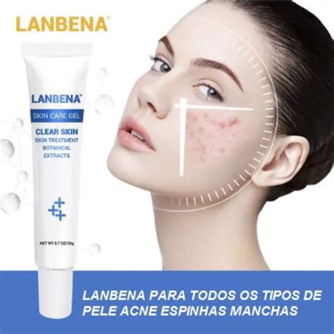 Lanbena Creme Tratamento Removedor Acne Cicatriz Manchas G Mercadolivre