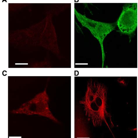 Immunofluorescent Confocal Microscopy Imaging Of Ii Tubulin And Vdac