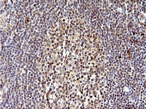 Sex Hormone Binding Globulin Mouse Monoclonal Antibody [clone Id Oti1h10]