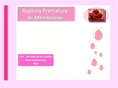 Ppt Ruptura Prematura De Membranas Powerpoint Presentation Free