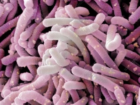 Lactobacillus casei shirota (SEM) - Stock Image - C014/9332 - Science ...