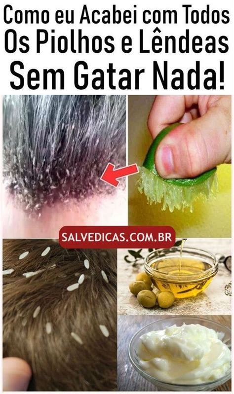 Remédio Caseiro Para Matar Piolho - Salve Dicas | Remedio para piolho, Peeling caseiro, Piolhos e lendeas