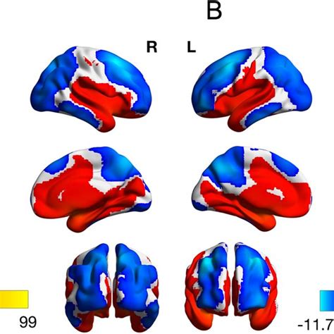 Left And Right Amygdala Functional Connectivity In The Whole Sample