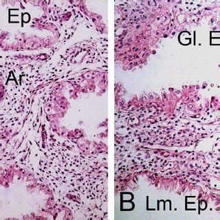 Micrographs obtained from H-E stained sections of decidual tissues from... | Download Scientific ...