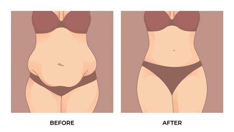 Belly Fat Before And After Weight Loss Woman Body Shape