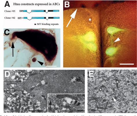 Figure 1 From Human Tau Filaments Induce Microtubule And Synapse Loss