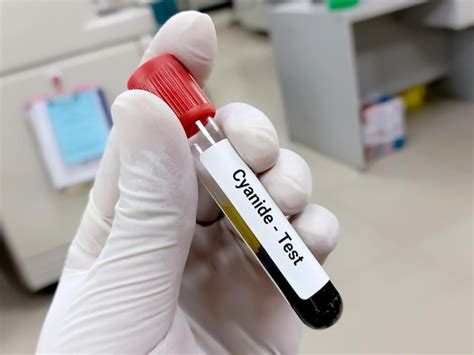 Premium Photo Biochemist Or Doctor Holds Blood Sample For Cyanide Test