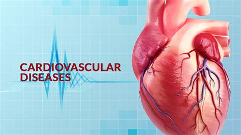 Cardio Vascular Diseases Types Symptoms Risk Factors Treatment