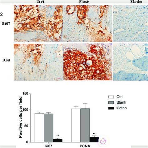 Overexpression Of Klotho Inhibits Osteosarcoma Cell Proliferation In