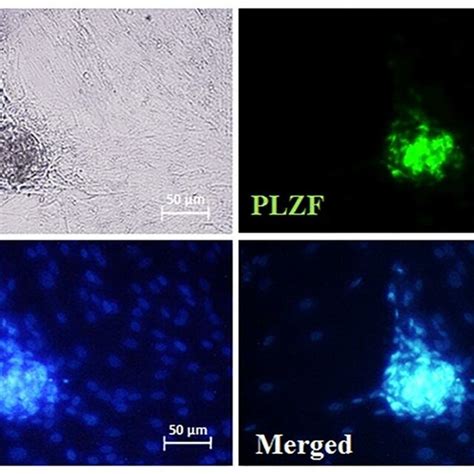 Sscs Characterization After Seven Days Of Culturing The Sscs Colonies