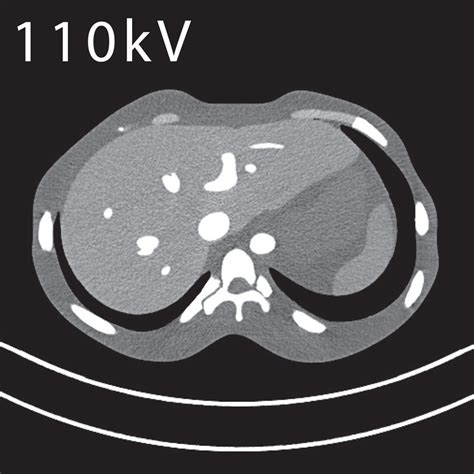 Ct Abdomen Phantom Kyoto Kagaku