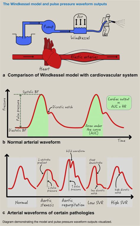 Cardiac Output Monitoring Anaesthesia Intensive Care Medicine