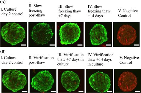 Three Dimensional Testicular Organoid A Novel Tool For The Study Of