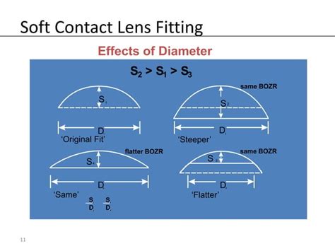 Soft Contact Lens Fitting