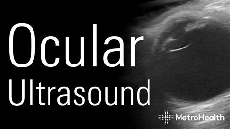 Ocular Ultrasound YouTube