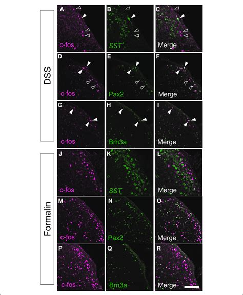 Immunostaining of c-fos together with several molecular markers in the ... 