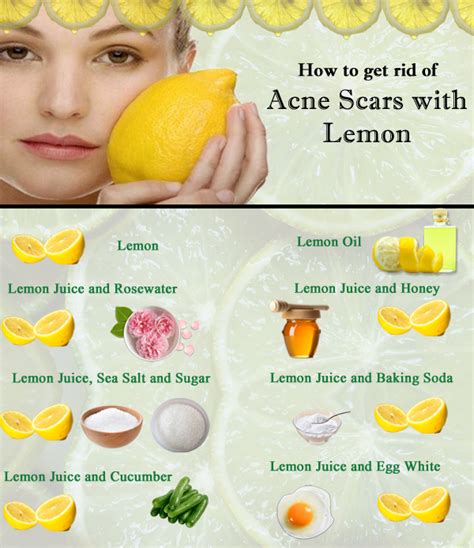 Lemon Juice On Acne Before And After Before And After