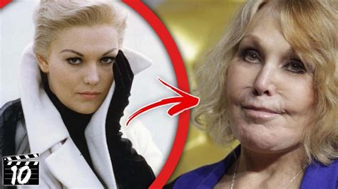 50 Celebrities Who Look Unrecognizable After Plastic Surgery YouTube