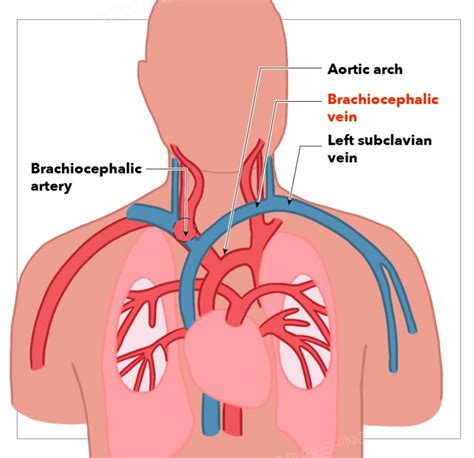 Anatomy Thorax Brachiocephalic Innominate Veins Treatment And Management Point Of Care