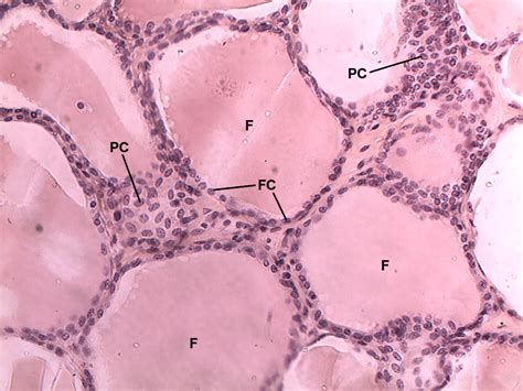 Thyroid 20x Histology