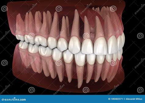 Morfología De Las Encías Y Dientes Humanos Mandibulares Y Maxilares