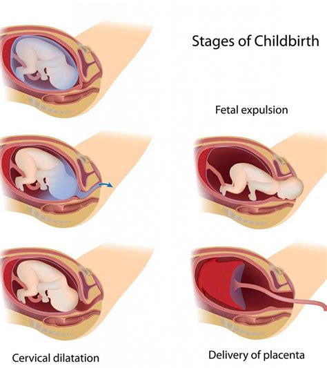 3 Vital Stages Of Labor: What Happens In Them And What To Do