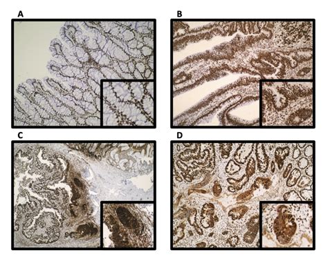 Representative Photomicrographs A Strong Nuclear And Absent Download Scientific Diagram