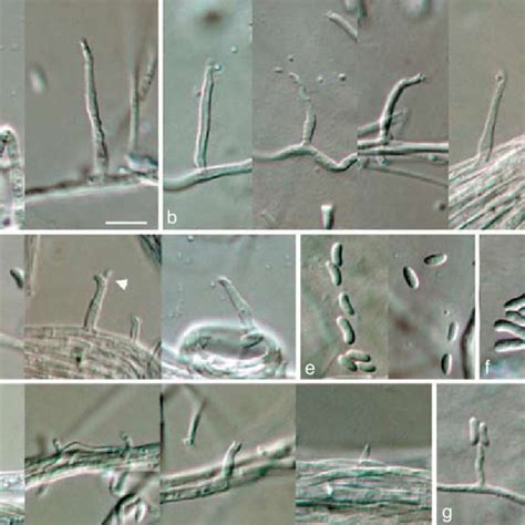 Phaeoacremonium Fuscum A −f Aerial Structures On Mea A