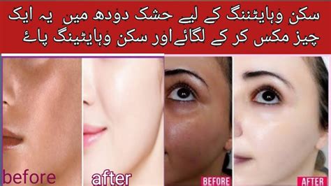 Skin Whitening Home Remedies Live Results Skin Ko White Karne Ka