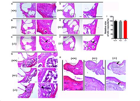 Histological Examination Of The Otic Capsule And Auditory Ossicles In