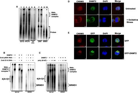 DNMT2 Binds To And Co Localizes With MRNA In Stress Granules A DNMT2