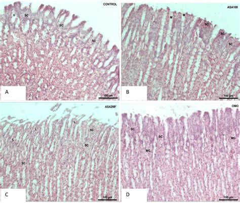 Histomorphological Observation Of Gastric Mucosae In Indomethacin Or